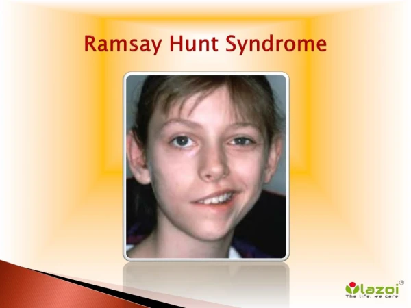 Ramsay Hunt Syndrome: Causes, Symptoms, Daignosis, Prevention and Treatment
