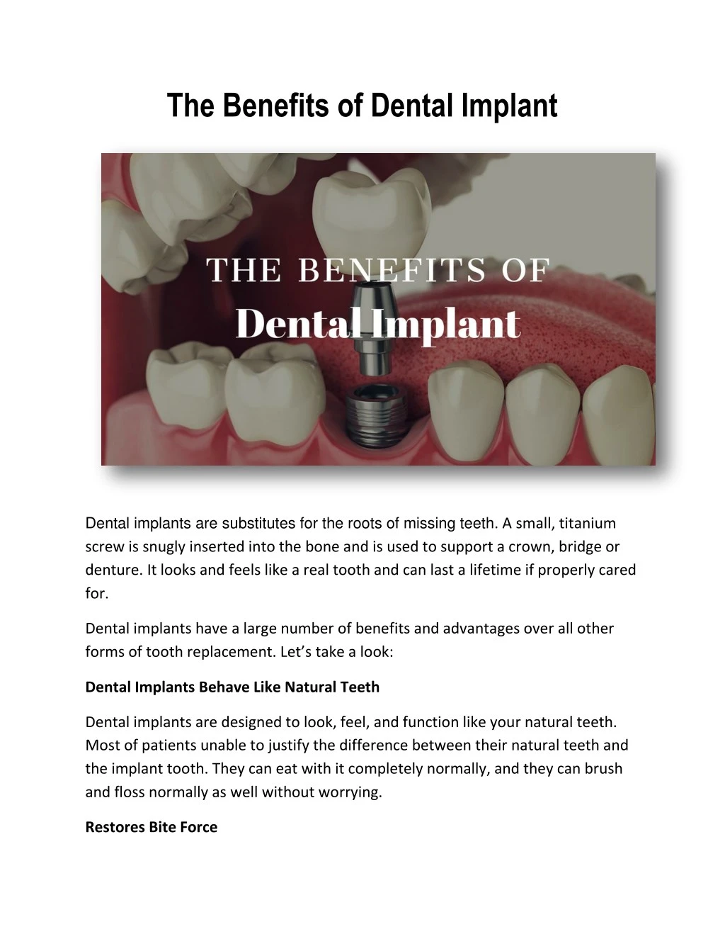 the benefits of dental implant