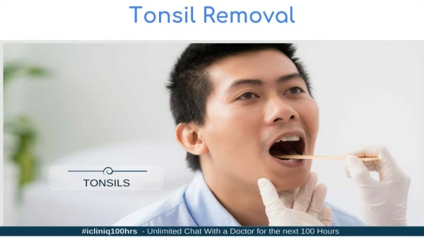Tonsil Removal