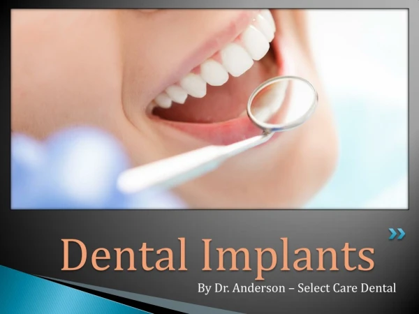 Dental Implants By Dr. Anderson - Select Care Dental