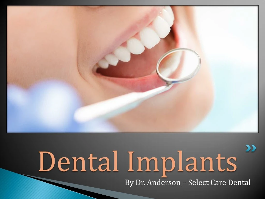 dental implants