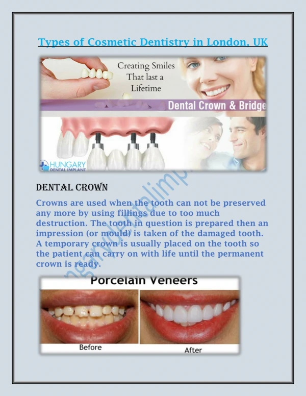 Types of Cosmetic Dentistry in London, UK
