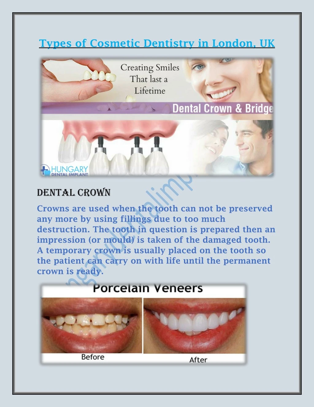 types of cosmetic dentistry in london uk