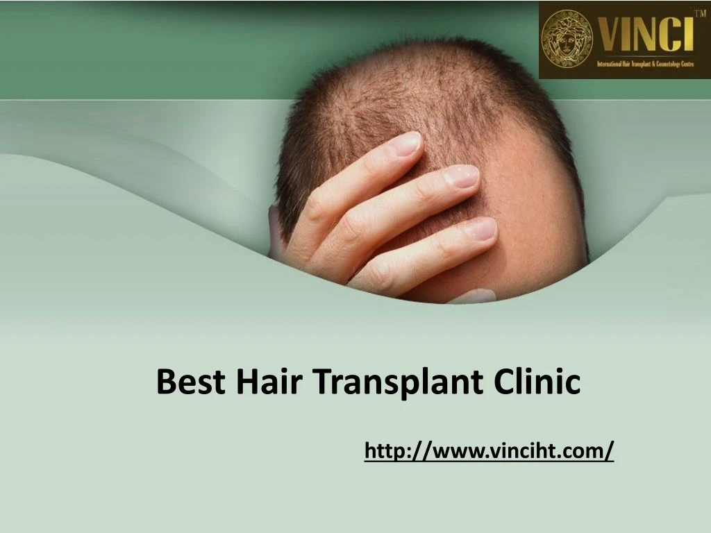 best hair transplant clinic