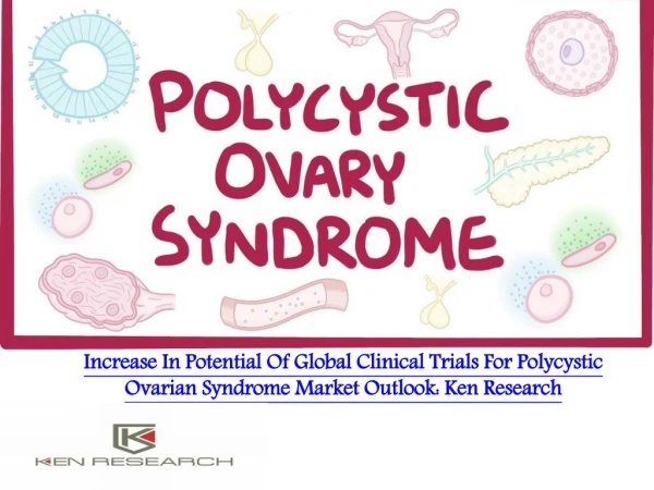 Polycystic Ovarian Syndrome Global Clinical Trials Review, H1, 2018