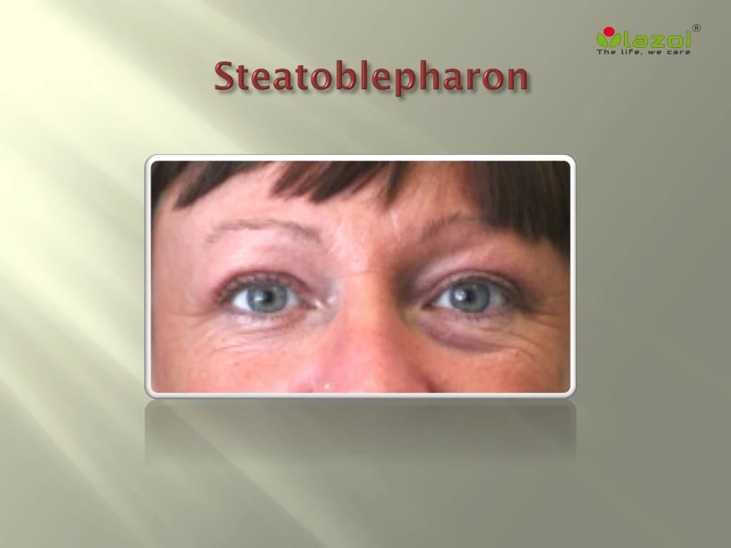 steatoblepharon