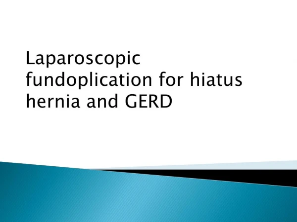 Laparoscopic fundoplication for hiatus hernia and GERD