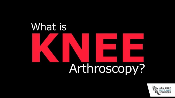 What is Knee Arthroscopy?