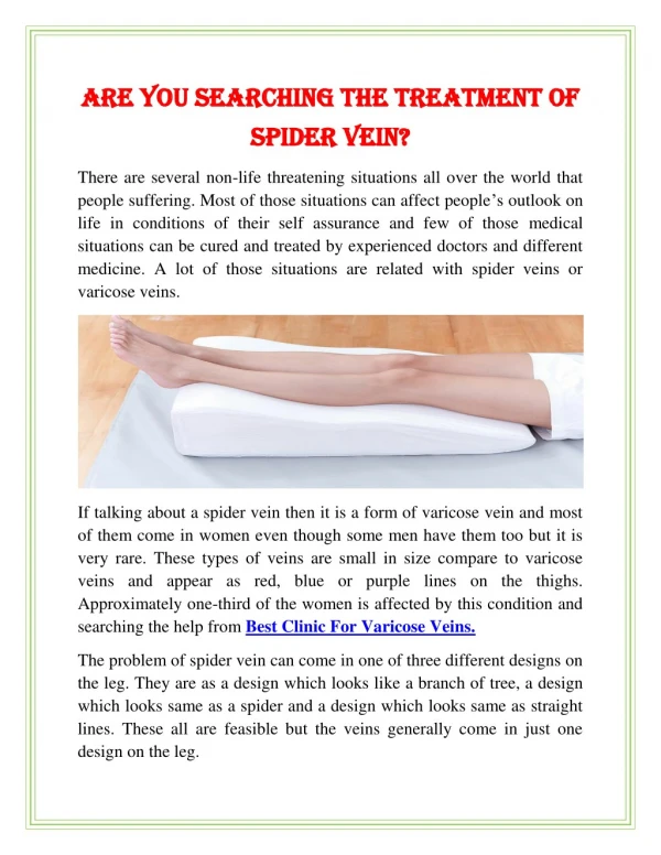 Are You Searching The Treatment of Spider Vein