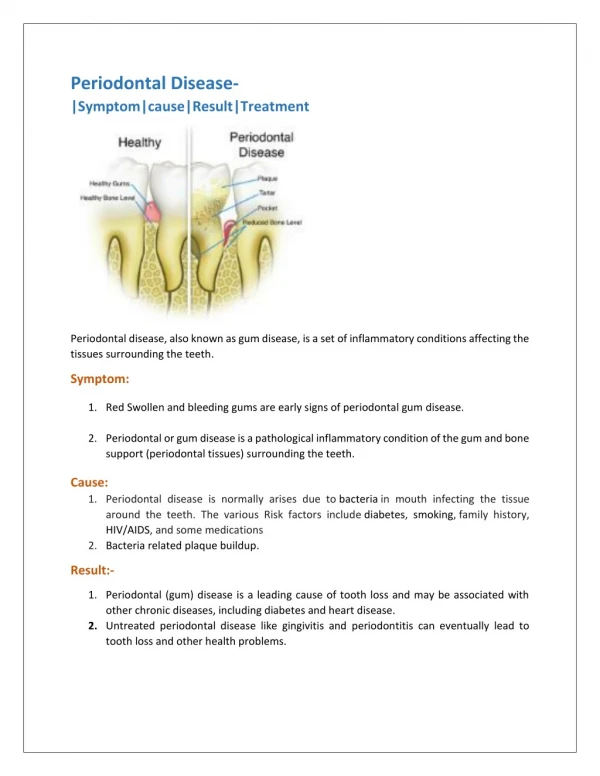 Periodontal Disease- |Symptom|cause|Result|Treatment