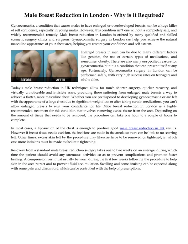 Male Breast Reduction in London - Why is it Required?