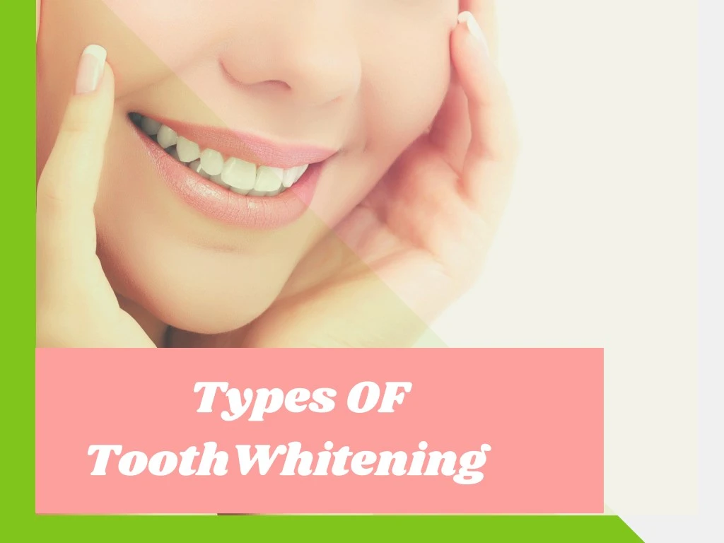 types of toothwhitening