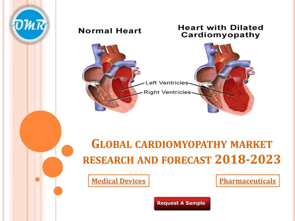 global cardiomyopathy market research and forecast 2018 2023