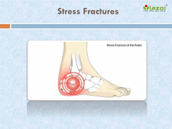 Stress Fractures: Causes, Symptoms, Daignosis, Prevention and Treatment
