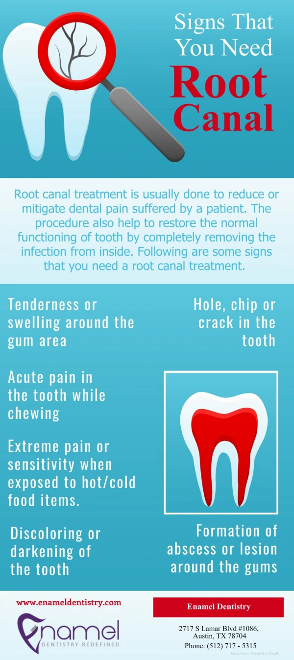 Signs That You Need Root Canal