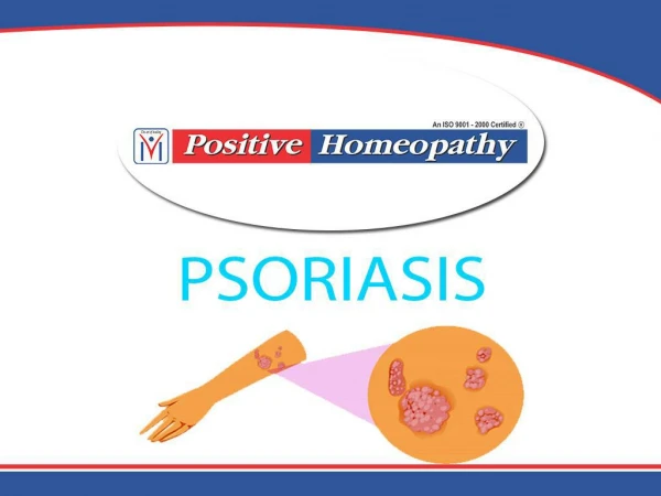 Homeopathy Treatment for Psoriasis in Bangalore | HomeopathyÂ Doctors in BangaloreÂ |