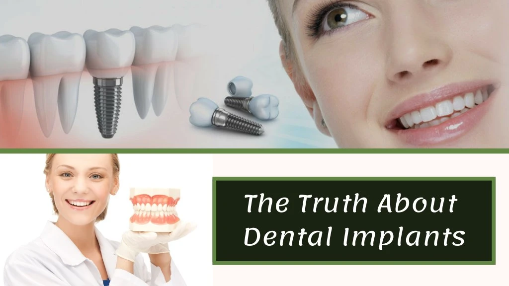 the truth about dental implants