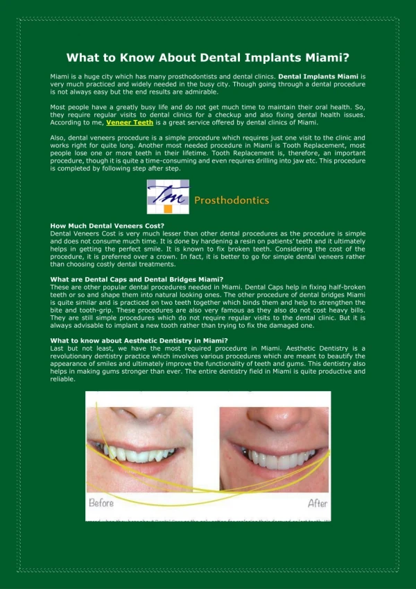 Teeth Implants Miami | Teeth Veneers Miami