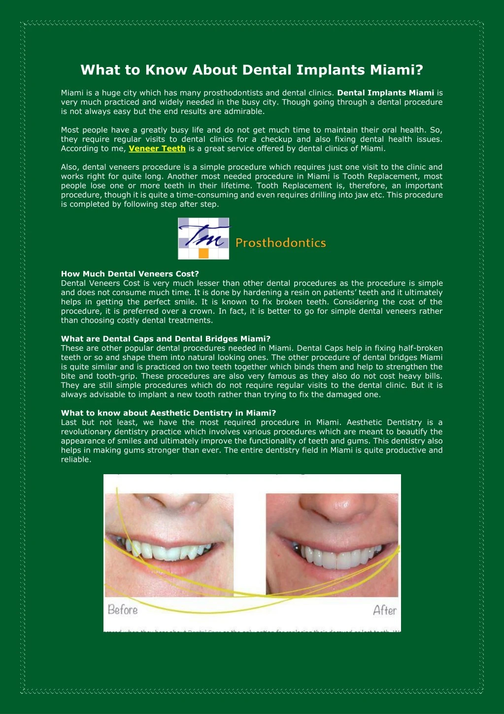 what to know about dental implants miami
