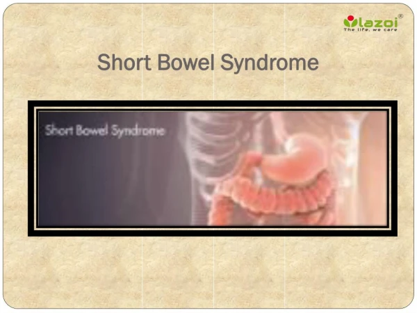 Short Bowel Syndrome: Causes, Symptoms, Daignosis, Prevention and Treatment