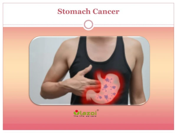 Stomach Cancer: Causes, Symptoms, Daignosis, Prevention and Treatment