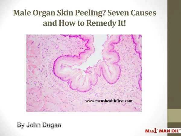 Male Organ Skin Peeling? Seven Causes and How to Remedy It!