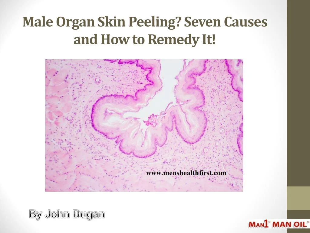 male organ skin peeling seven causes and how to remedy it