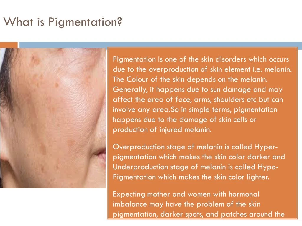 what is pigmentation