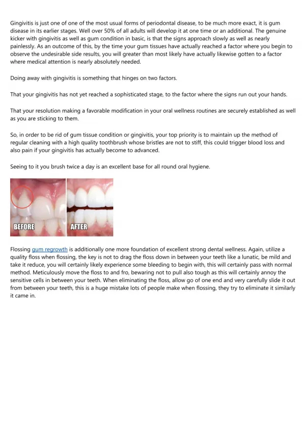 15 Best Pinterest Boards of All Time About healing receding gums