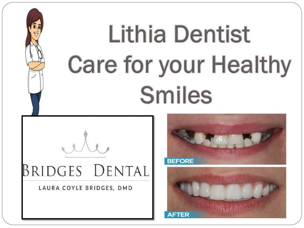 lithia dentist care for your healthy smiles
