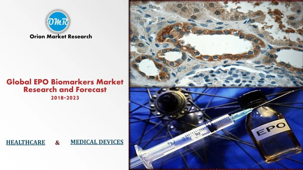 global epo biomarkers market research and forecast 2018 2023