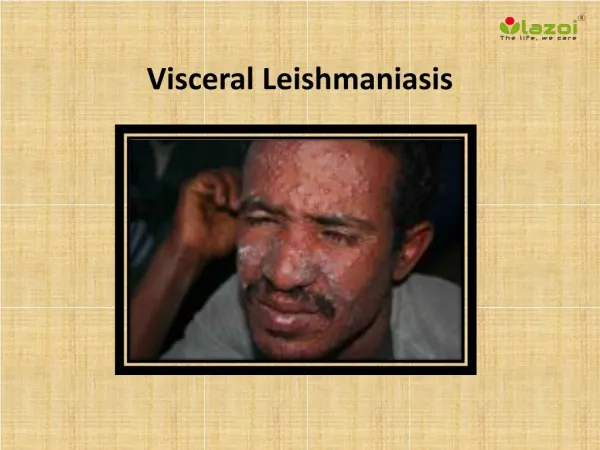 Visceral Leishmaniasis: Causes, Symptoms, Daignosis, Prevention and Treatment