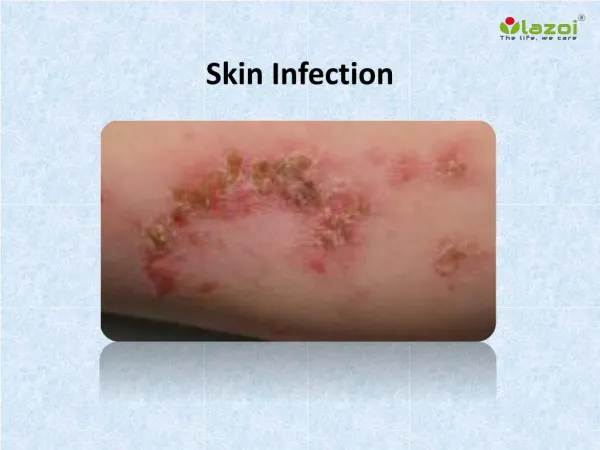 Skin Infection : Causes, Symptoms, Treatment, Prevention