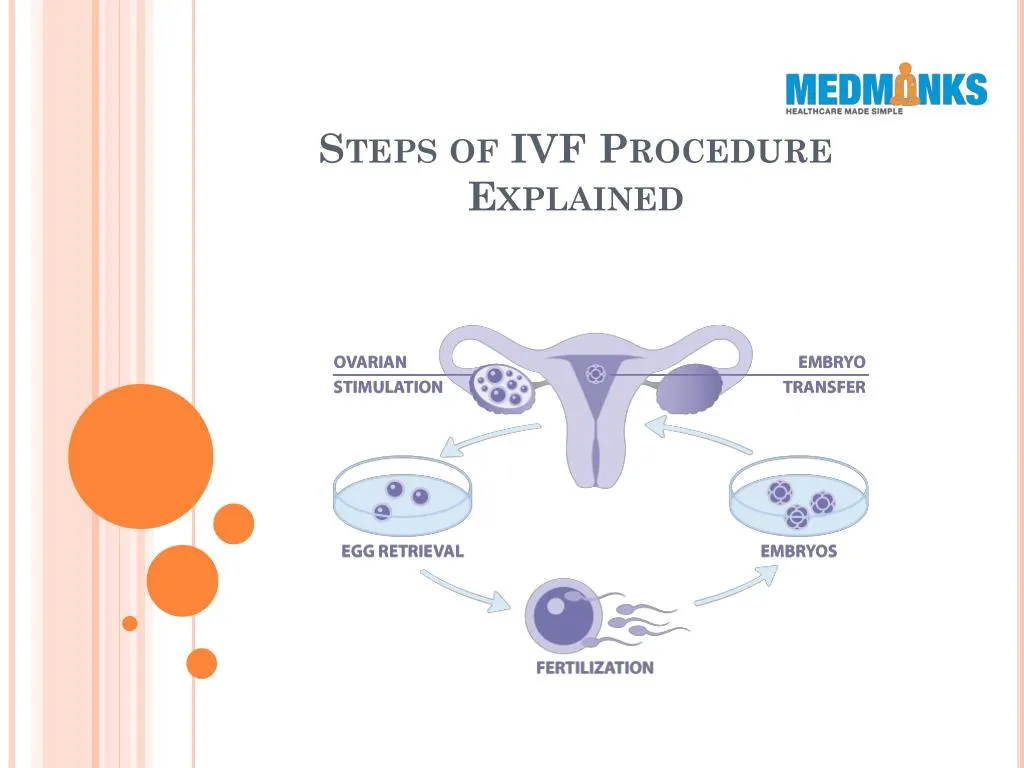 steps of ivf procedure explained