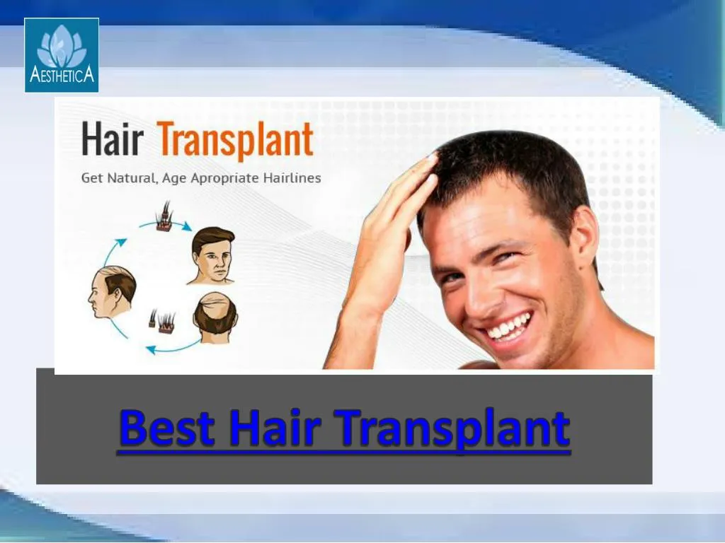 best hair transplant