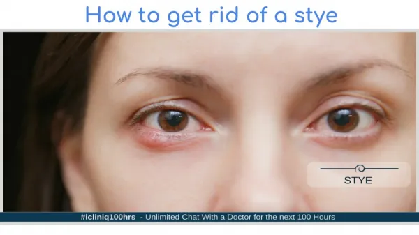 How to get rid of a stye?