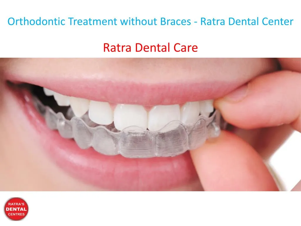orthodontic treatment without braces ratra dental