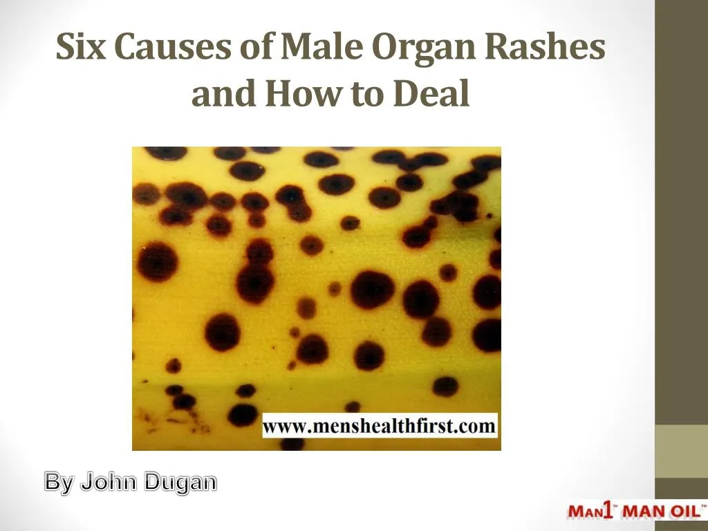 six causes of male organ rashes and how to deal
