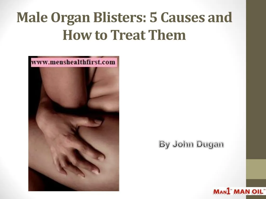 male organ blisters 5 causes and how to treat them