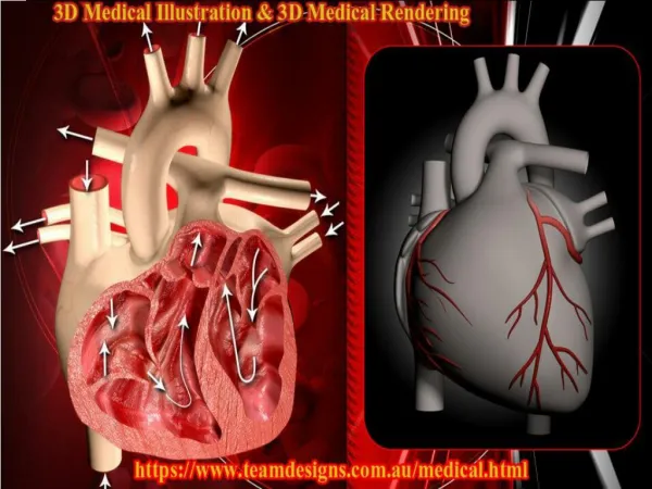 3D Medical Rendering | 3D Medical Illustration