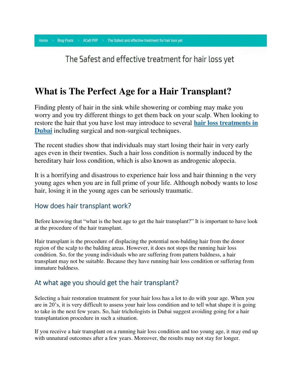 what is the perfect age for a hair transplant