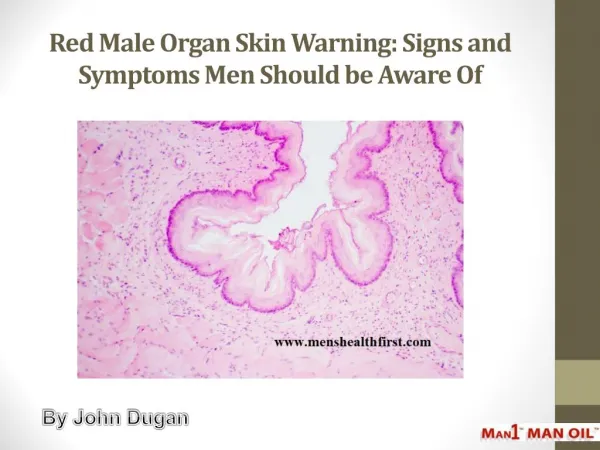 Red Male Organ Skin Warning: Signs and Symptoms Men Should be Aware Of