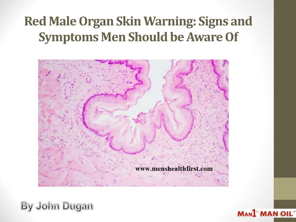 red male organ skin warning signs and symptoms men should be aware of