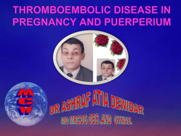 THROMBOEMBOLIC DISEASE IN PREGNANCY AND PUERPERIUM
