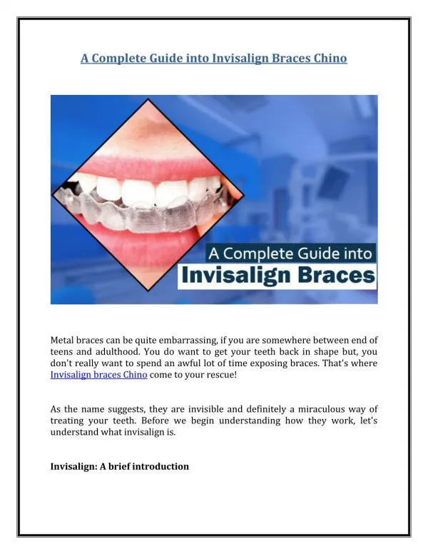 A Complete Guide into Invisalign Braces Chino