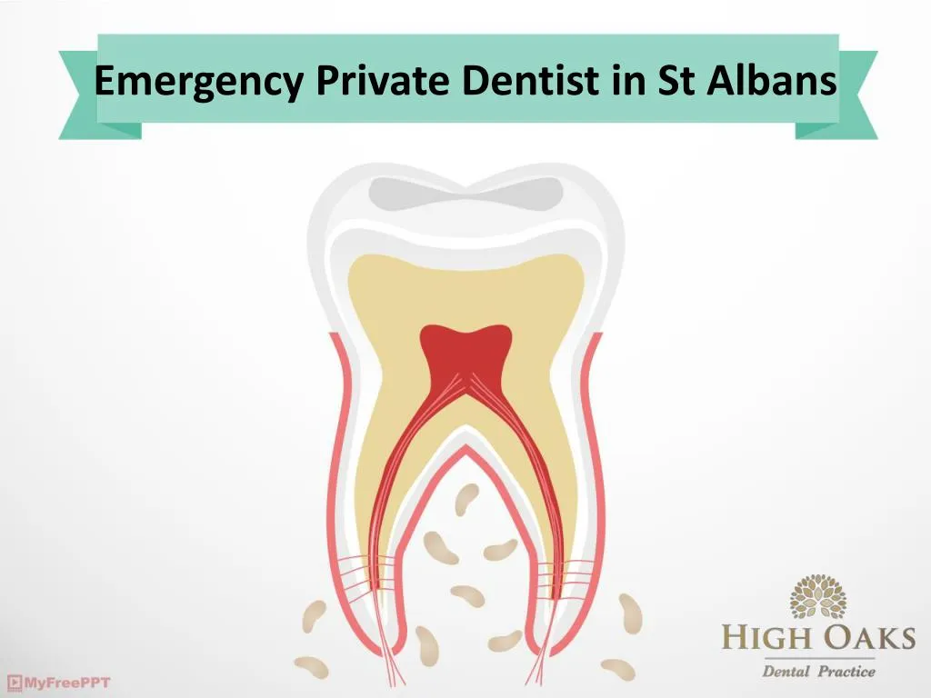 emergency private dentist in st albans