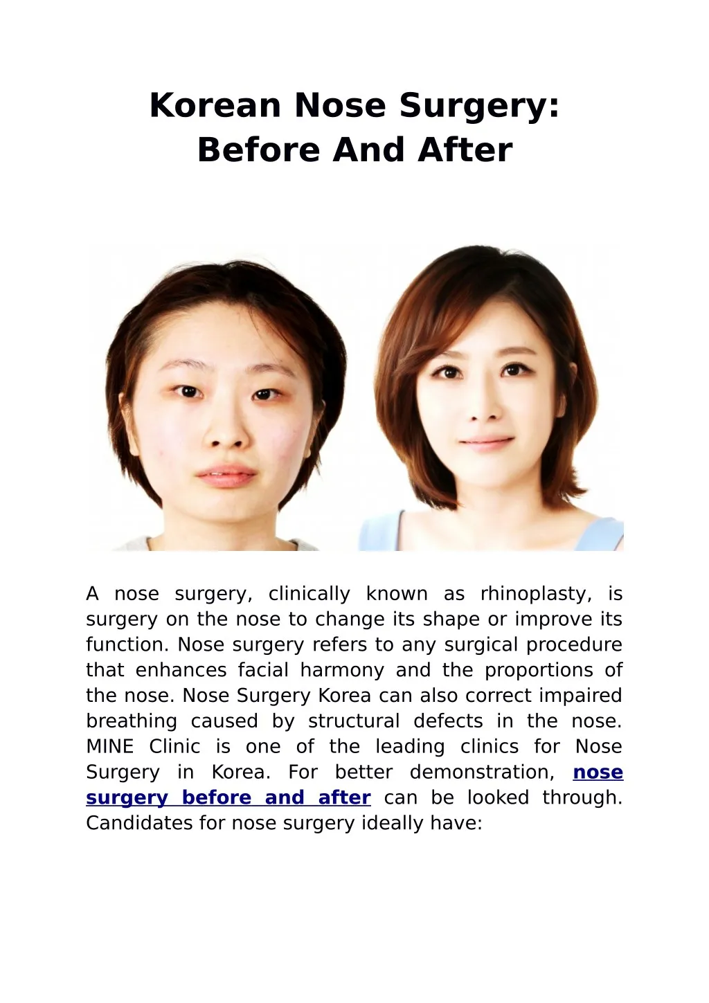korean nose surgery before and after