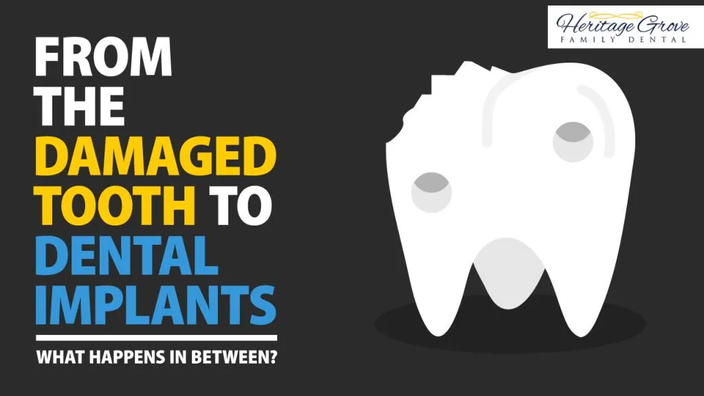 from the damaged tooth to dental implants what happens in between