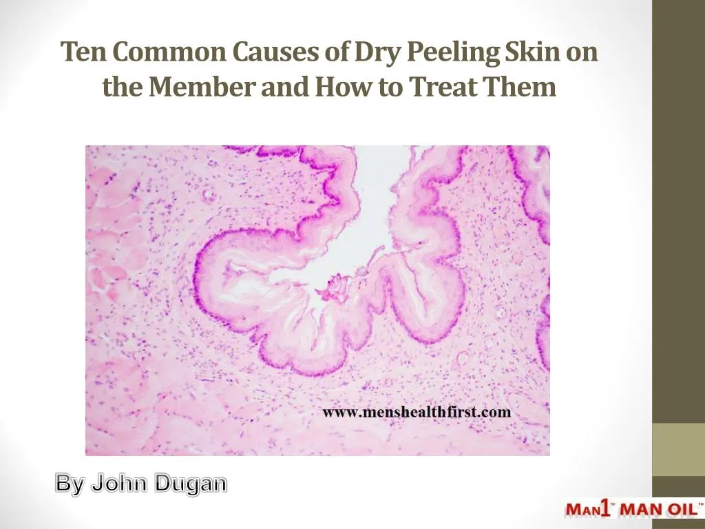 ten common causes of dry peeling skin on the member and how to treat them