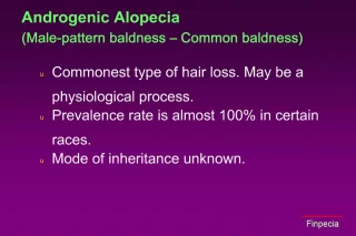 Androgenic Alopecia Male-pattern baldness Common baldness - slide 1